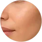 Maçãs do rosto
