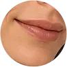 Outras áreas