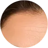 Testa