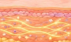 Ilustração das fibras de colágeno após a absorção do fio.